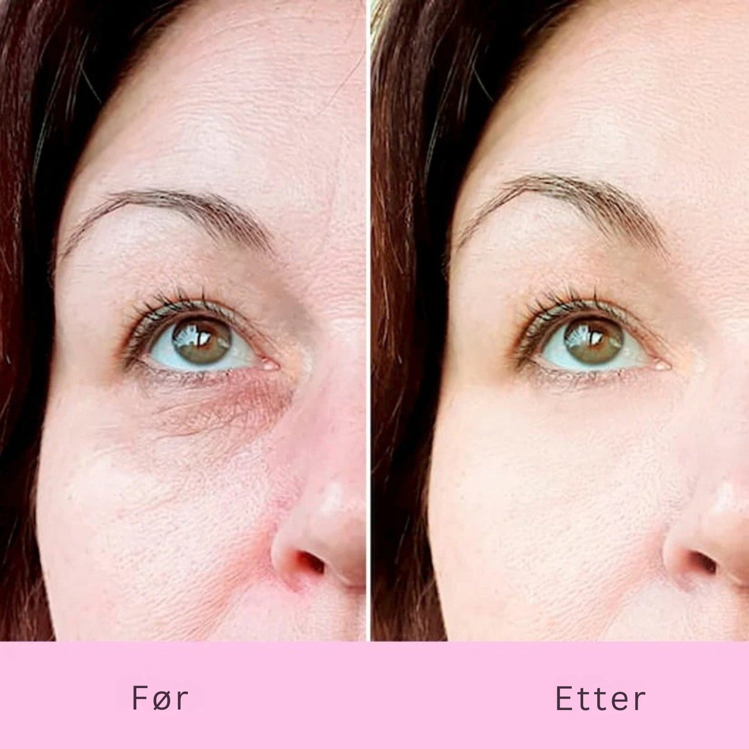 K-Beauty Eye Pads – Lysere øyne på 10 minutter