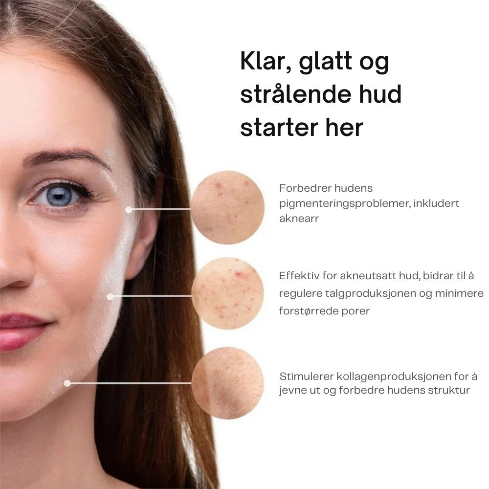 A313 – Vitamin A- og retinolkrem