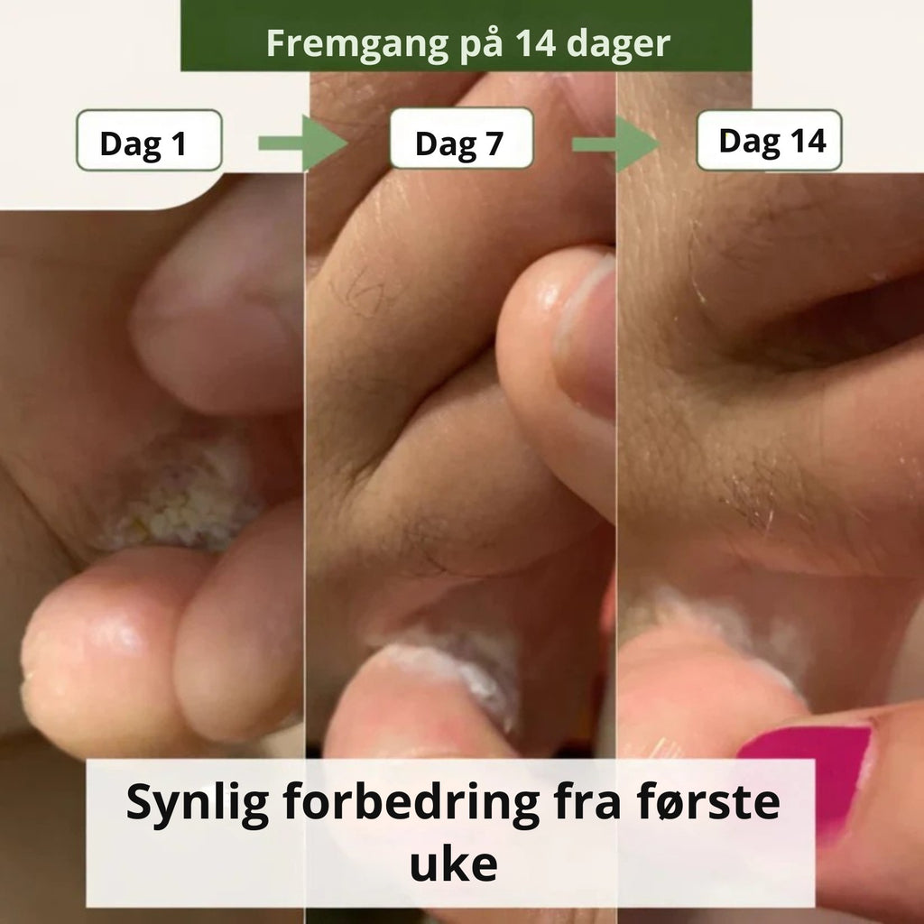 Nordist soppdrepende såpe