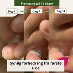 Nordist soppdrepende såpe