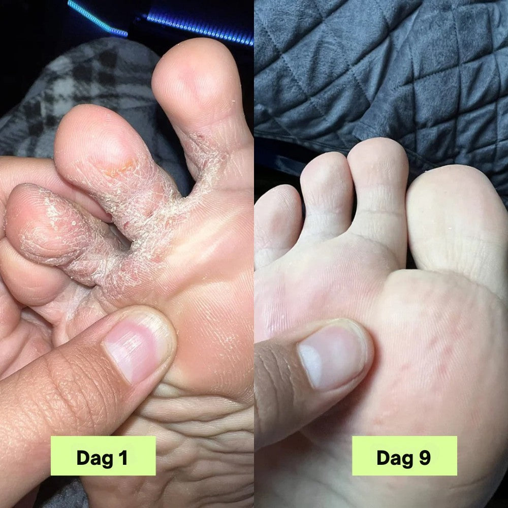 Nordist® Anti-Sopp Såpebar