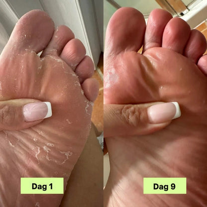 Nordist® Anti-Sopp Såpebar