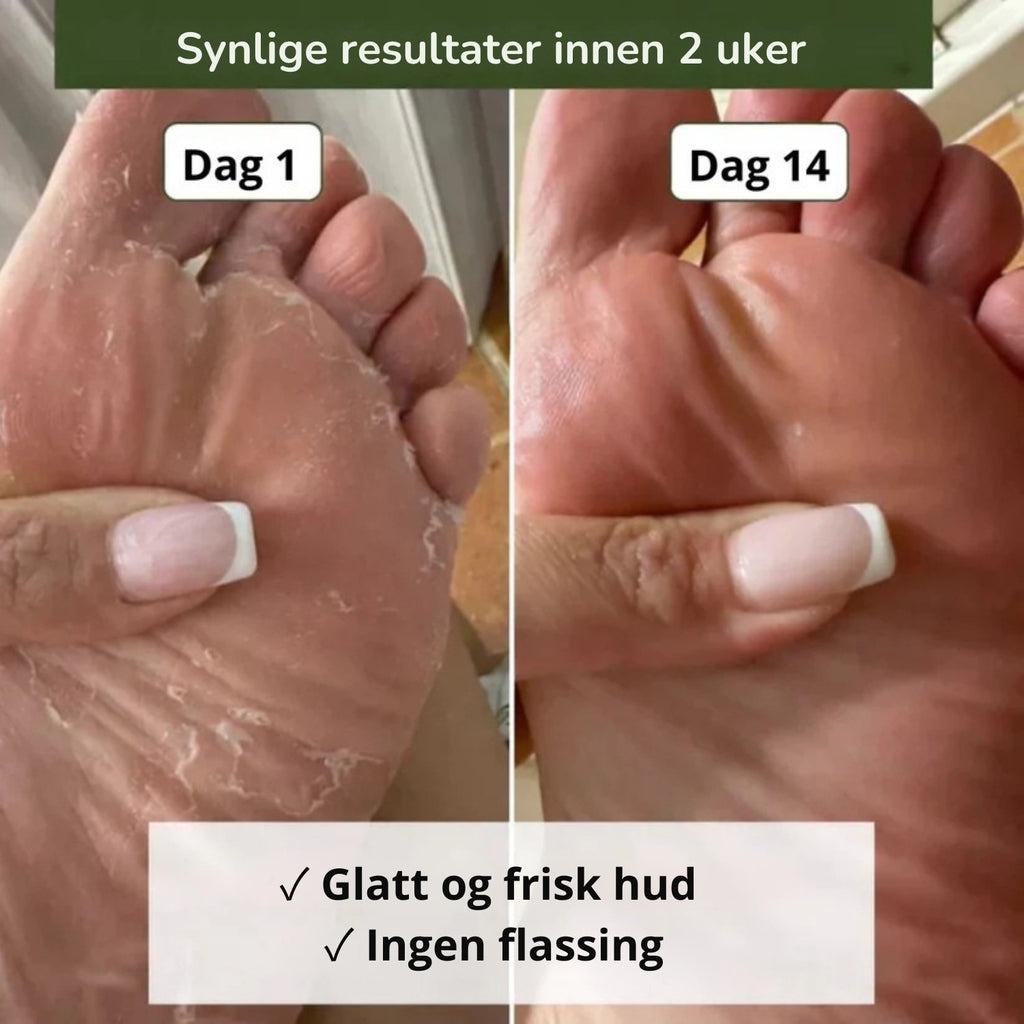 Nordist soppdrepende såpe