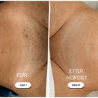 NORDIST 5-i-1 Barbermaskin