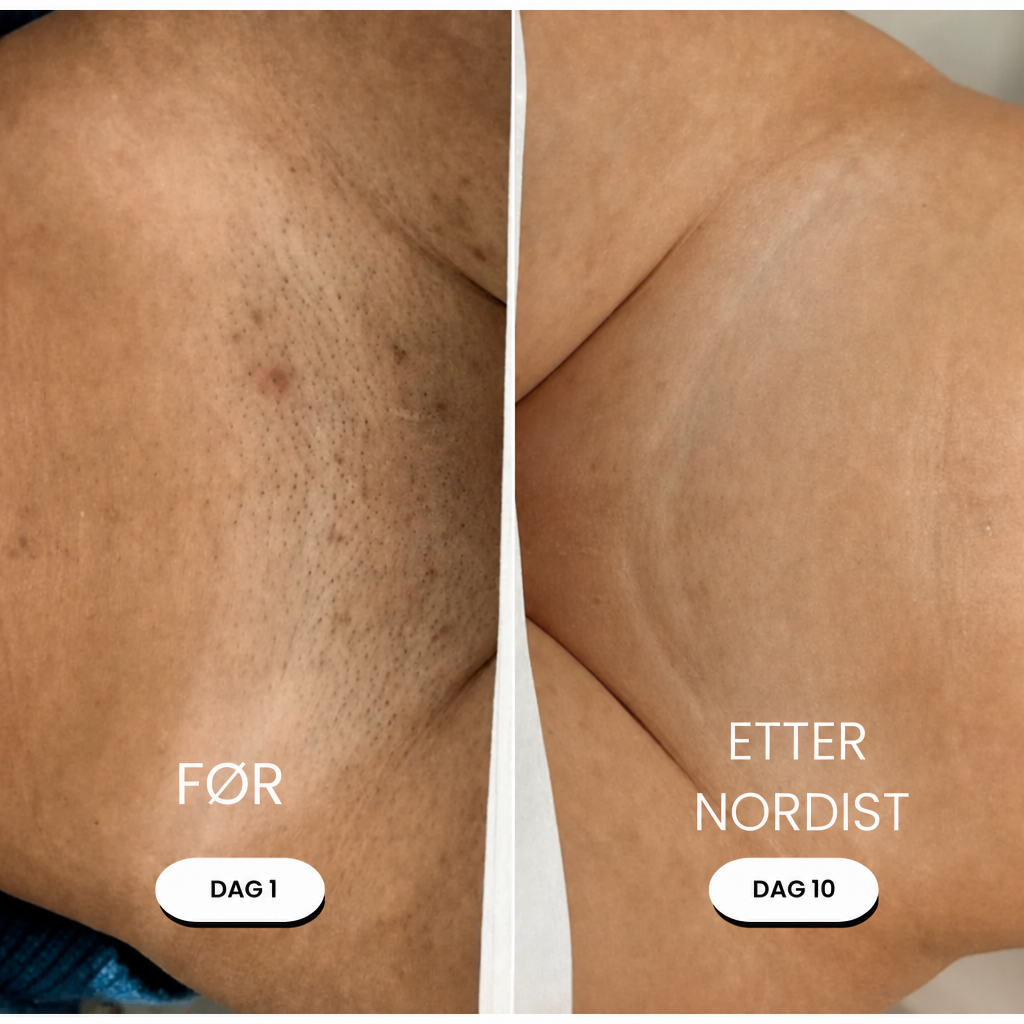 NORDIST 5-i-1 Barbermaskin