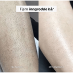 NORDIST 5-i-1 Barbermaskin