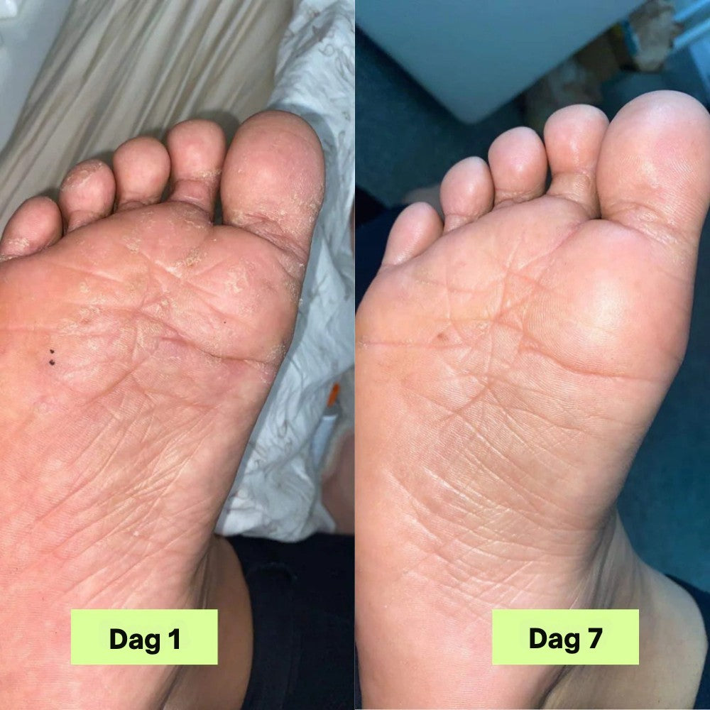 Nordist® Anti-Sopp Såpebar