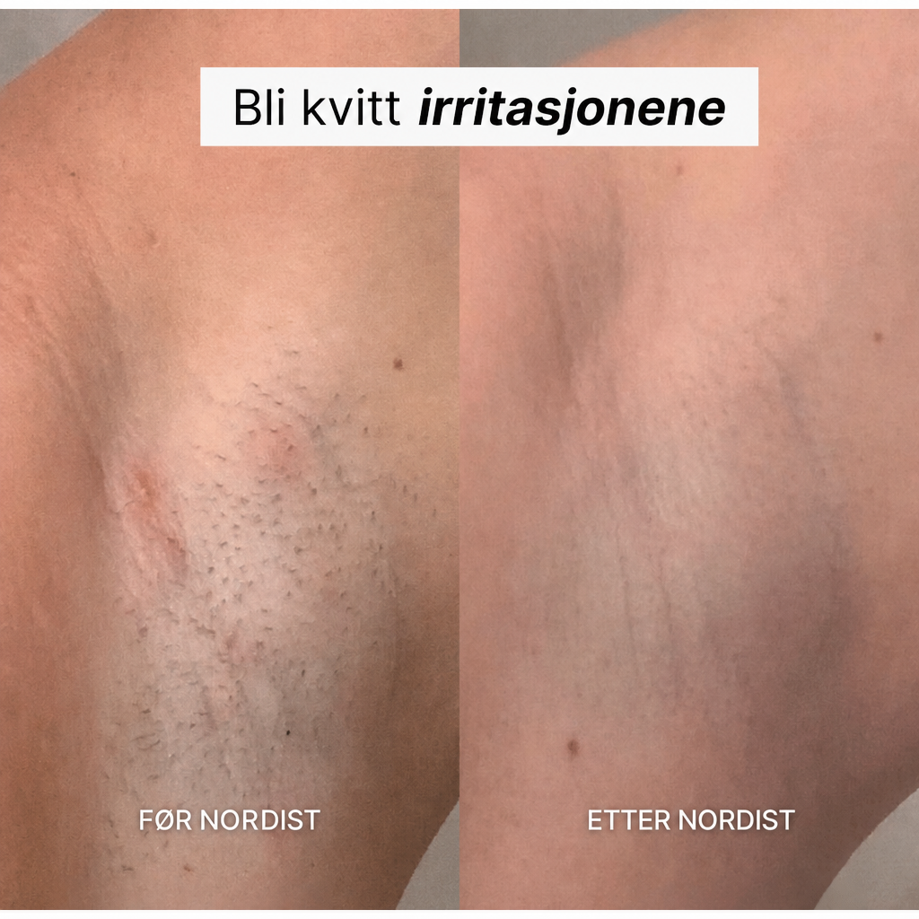 NORDIST 5-i-1 Barbermaskin