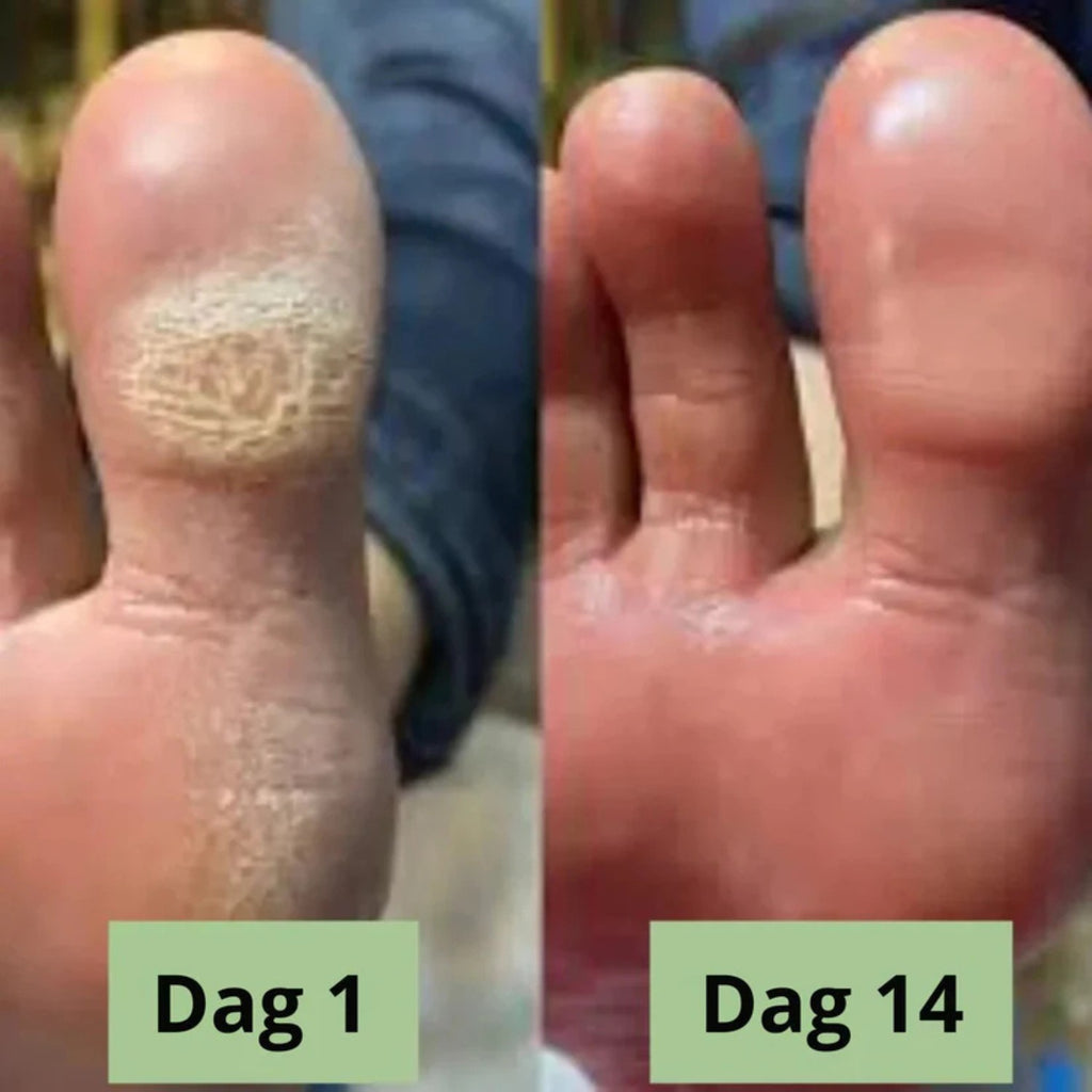 Nordist soppdrepende såpe