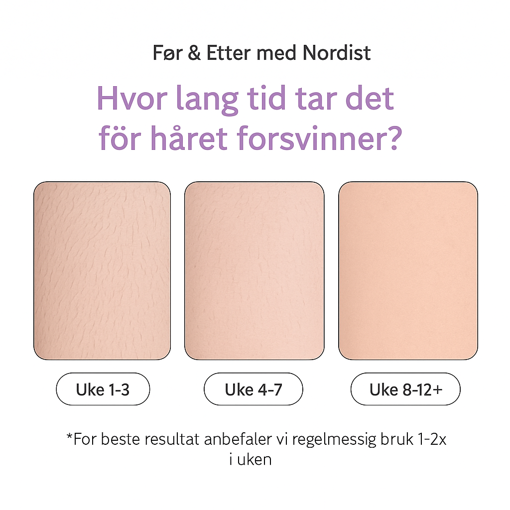 Nordist™ IPL — Permanent silkemyk hud hjemme