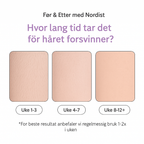 Nordist™ IPL — Permanent silkemyk hud hjemme