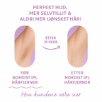 Nordist IPL før og etter