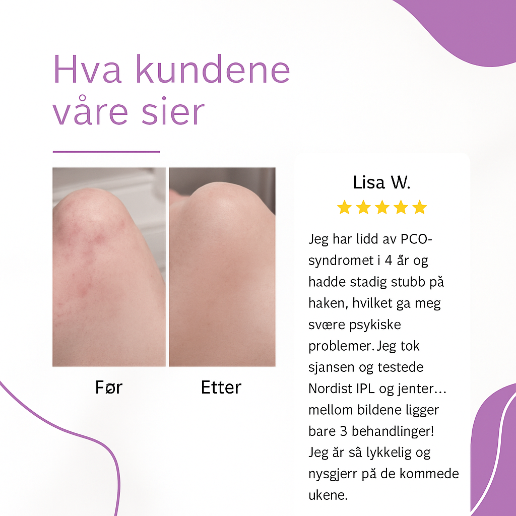 Nordist™ IPL — Permanent silkemyk hud hjemme
