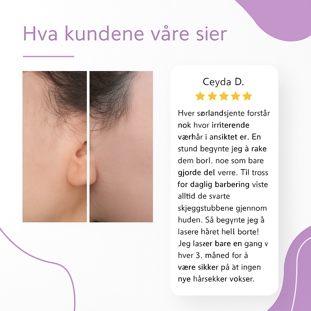 Nordist™ IPL — Permanent silkemyk hud hjemme
