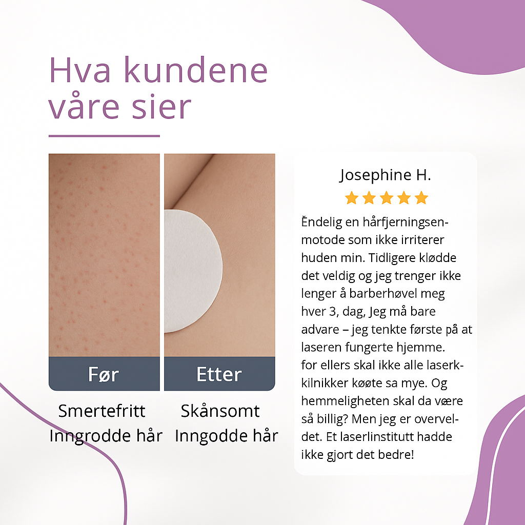 Nordist™ IPL — Permanent silkemyk hud hjemme