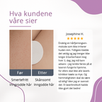 Nordist™ IPL — Permanent silkemyk hud hjemme