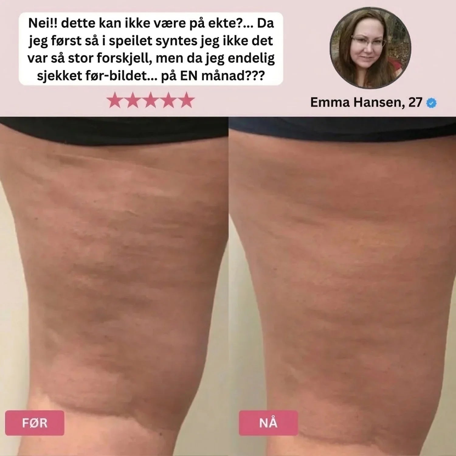 NORDIST® LymphFlow-massasjemaskin