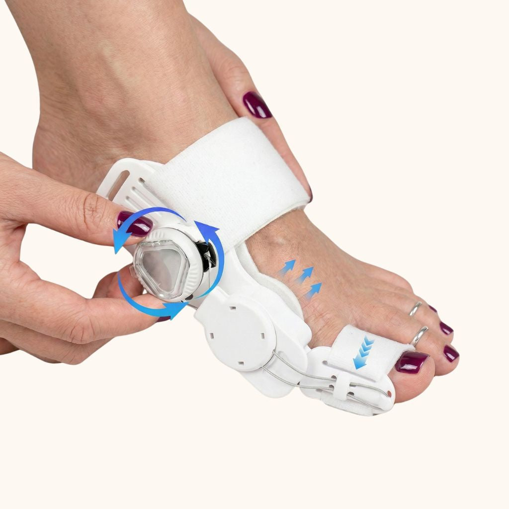 Hallux valgus før etter